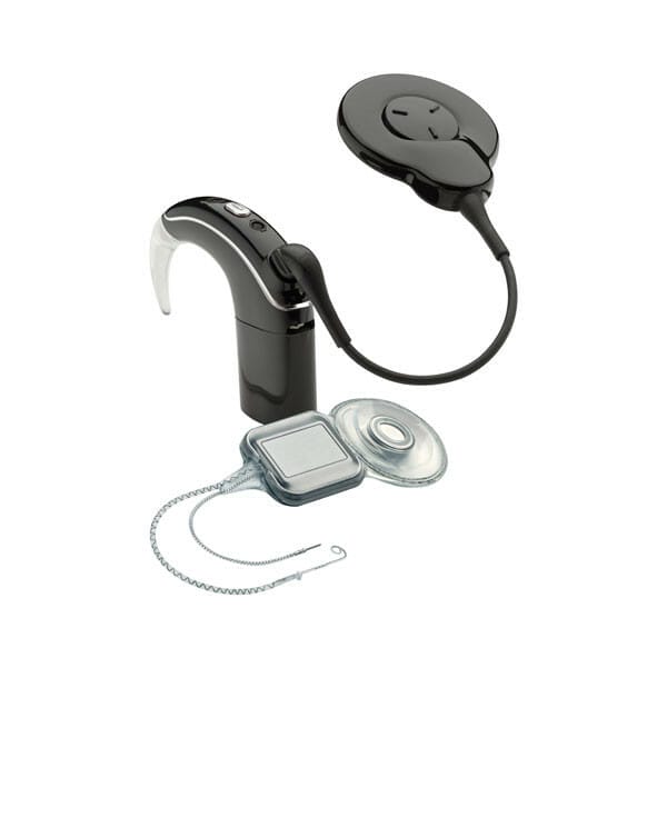 cochlear-implant